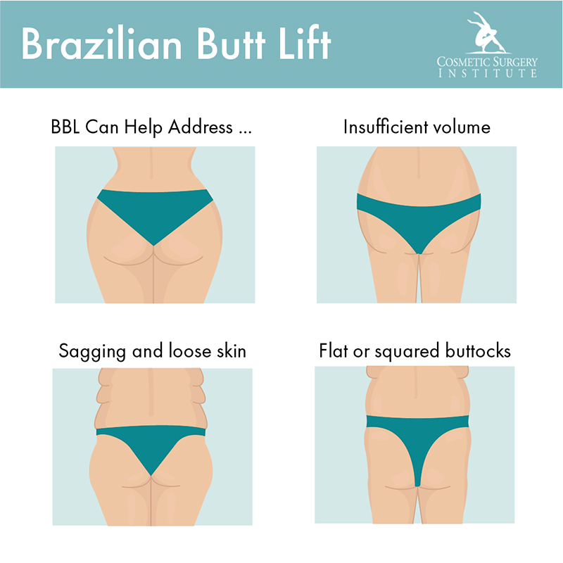 Discover what’s possible with a Brazilian butt lift at Palm Desert’s Cosmetic Surgery Institute.